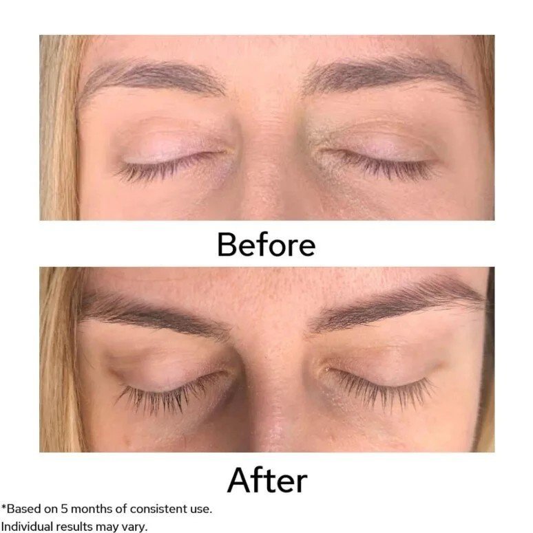 Dr. Lara Devgan Platinum Long Lash Review: A Dermatologist-Backed Approach to Fuller Lashes